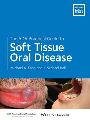 cover image of The ADA Practical Guide to Soft Tissue Oral Disease